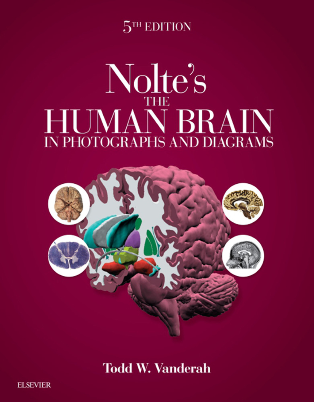 Nolte's The Human Brain in Photographs and Diagrams 5th Edition â€“ PDF/EPUB Version Downloadable