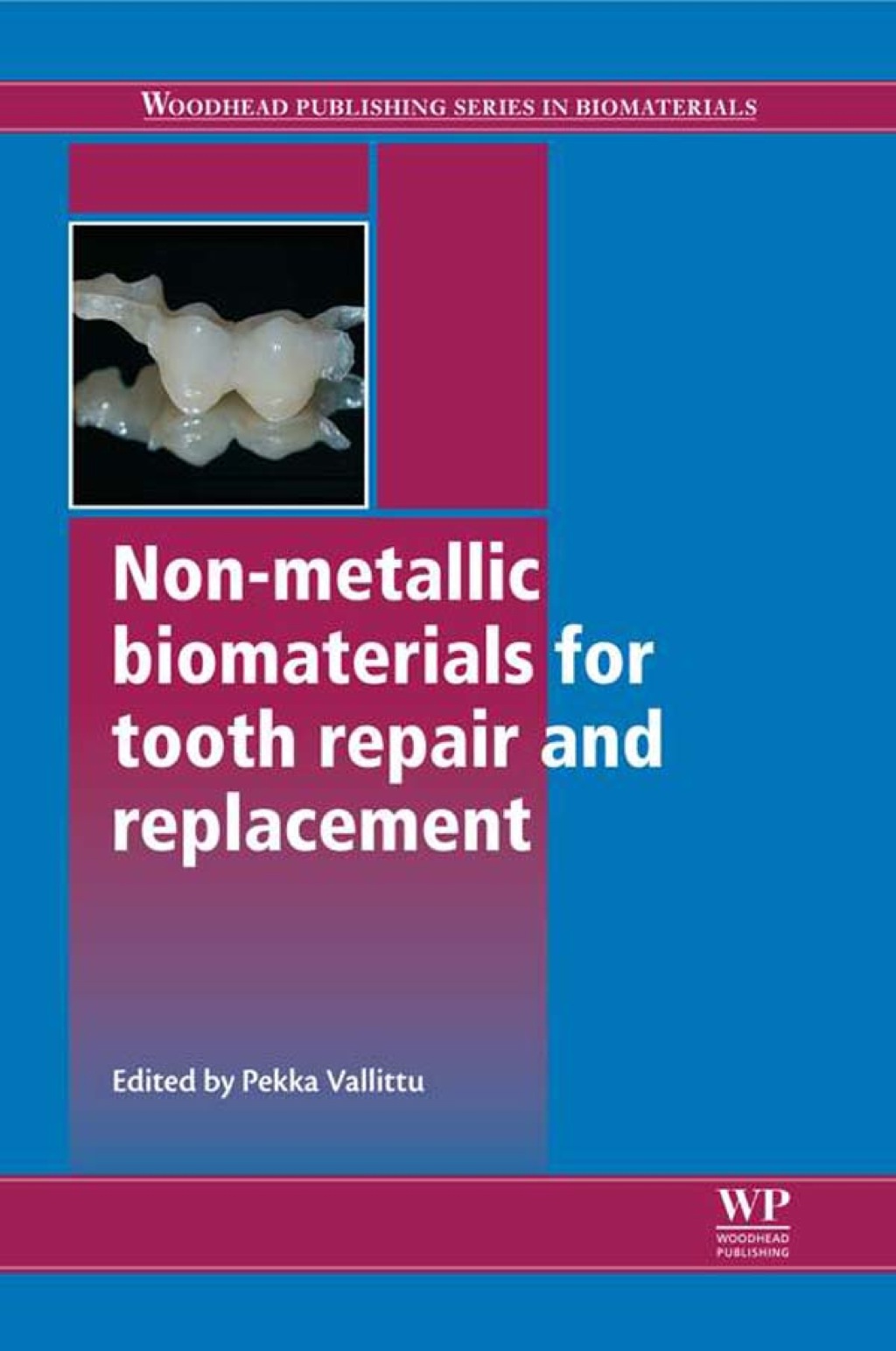 Non-Metallic Biomaterials for Tooth Repair and Replacement  â€“ PDF/EPUB Version Downloadable