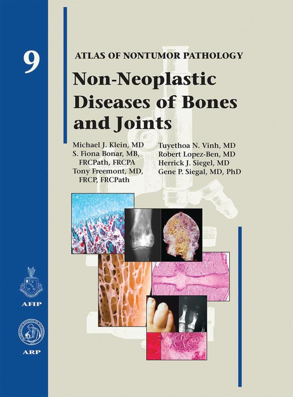Non-Neoplastic Diseases of Bones and Joints 1st Edition â€“ PDF/EPUB Version Downloadable