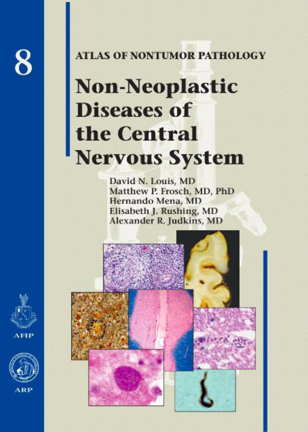 Non-Neoplastic Diseases of the Central Nervous System 1st Edition â€“ PDF/EPUB Version Downloadable