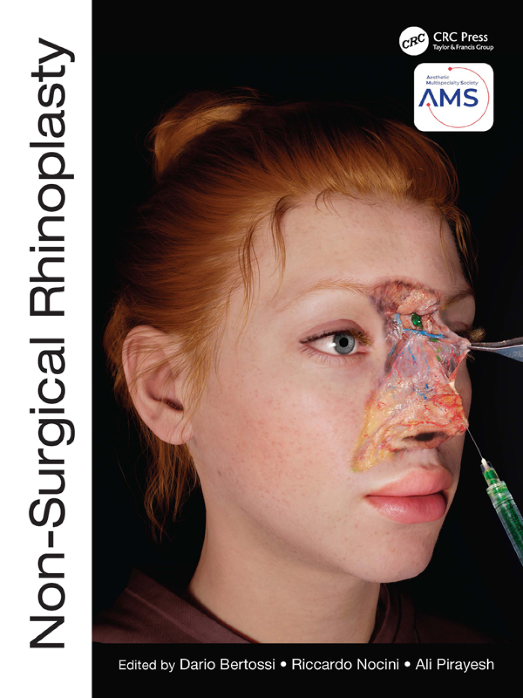 Non-Surgical Rhinoplasty 1st Edition â€“ PDF/EPUB Version Downloadable