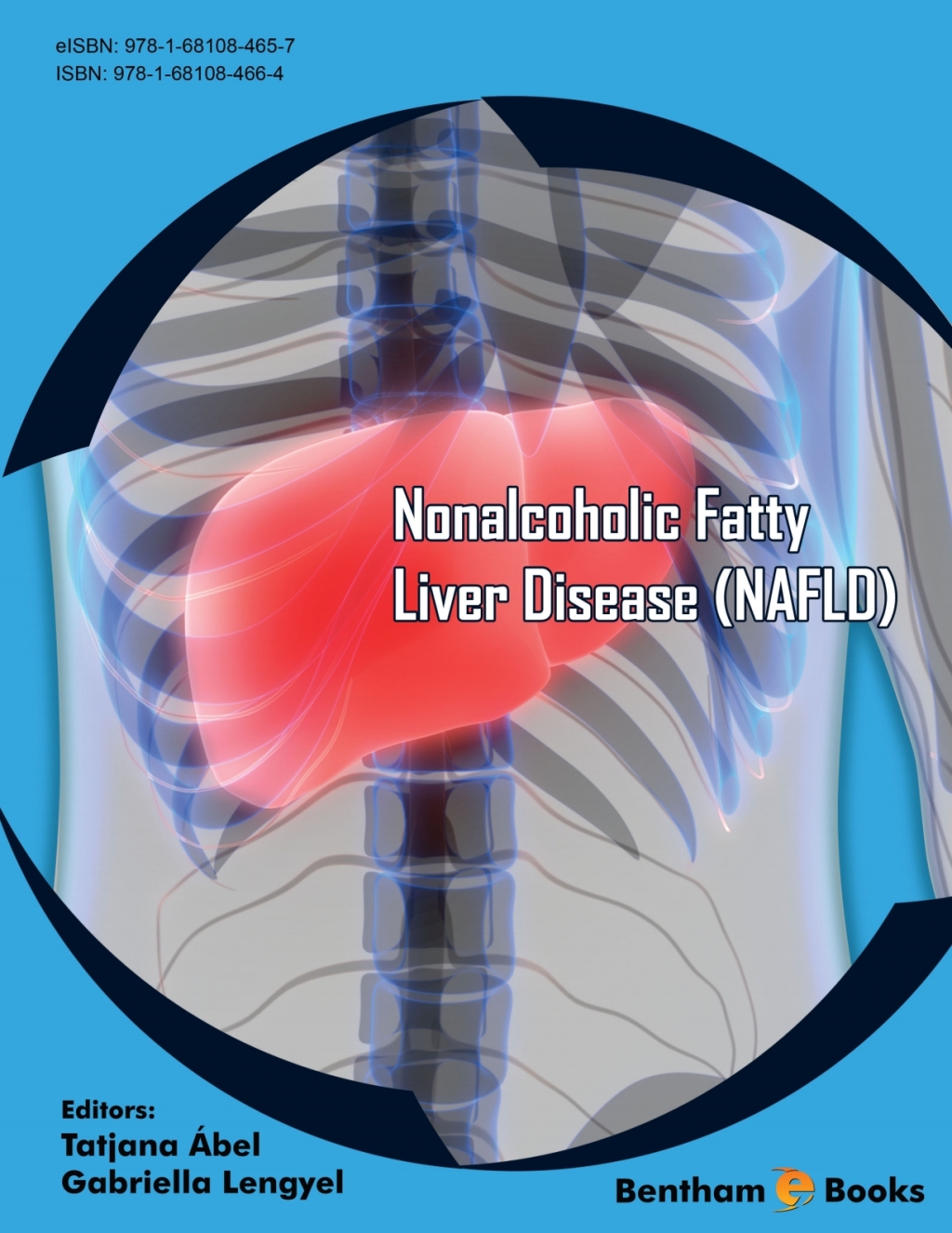 Nonalcoholic Fatty Liver Disease (NAFLD) 1st Edition â€“ PDF/EPUB Version Downloadable
