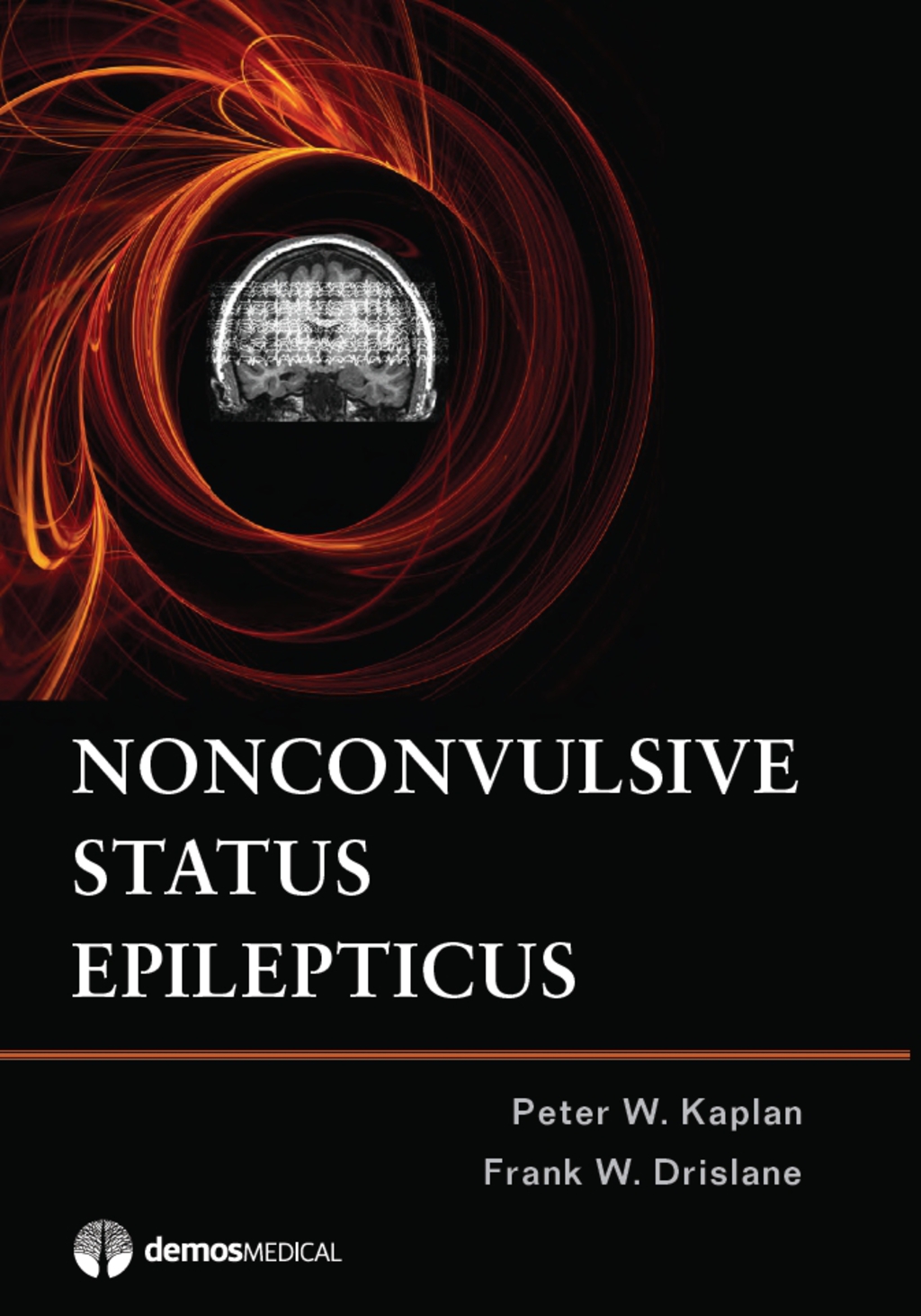 Nonconvulsive Status Epilepticus 1st Edition â€“ PDF/EPUB Version Downloadable