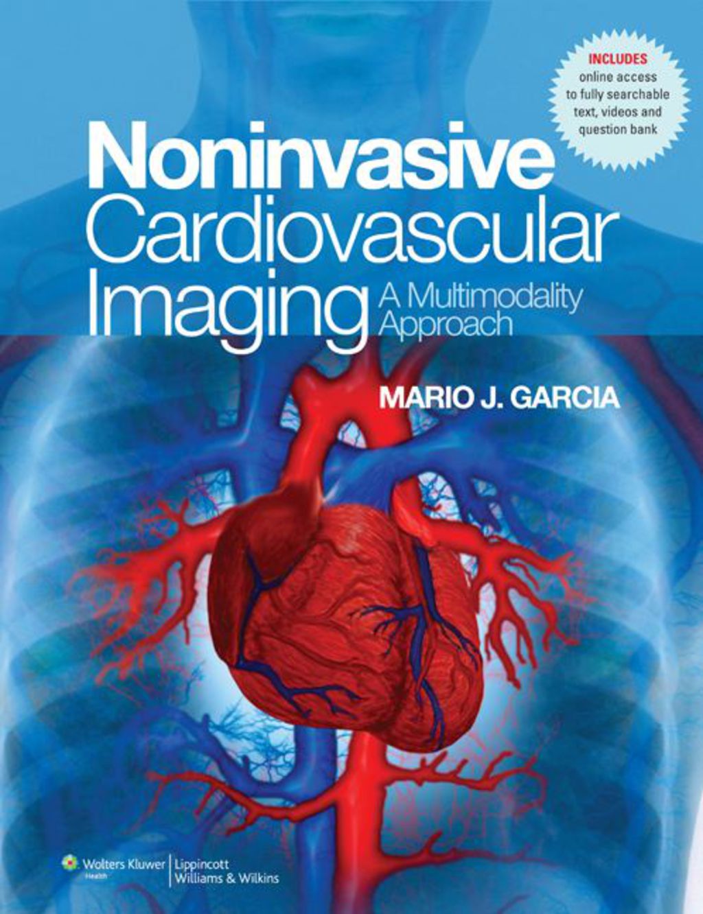 NonInvasive Cardiovascular Imaging: A Multimodality Approach 1st Edition â€“ PDF/EPUB Version Downloadable