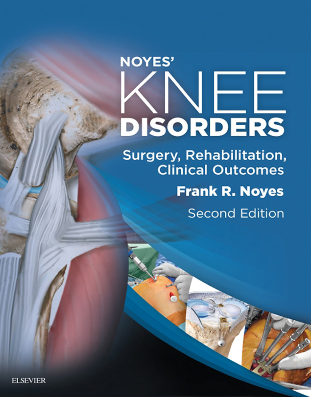 Noyes' Knee Disorders: Surgery, Rehabilitation, Clinical Outcomes 2nd Edition â€“ PDF/EPUB Version Downloadable