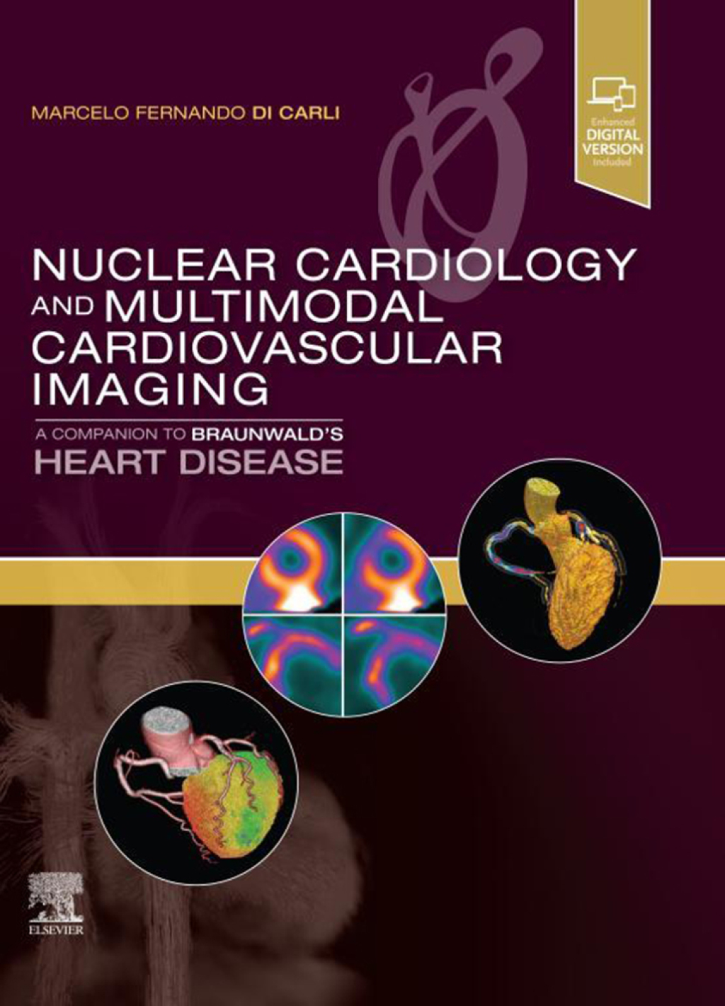 Nuclear Cardiology and Multimodal Cardiovascular Imaging A Companion to Braunwald's Heart Disease  â€“ PDF/EPUB Version Downloadable