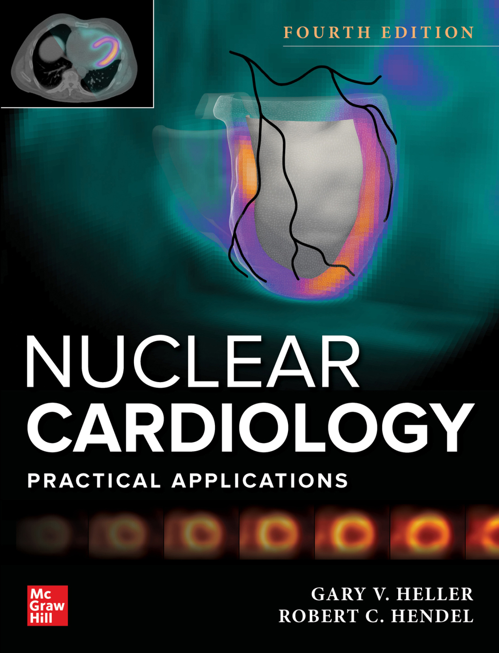 Nuclear Cardiology: Practical Applications, Fourth Edition 4th Edition â€“ PDF/EPUB Version Downloadable