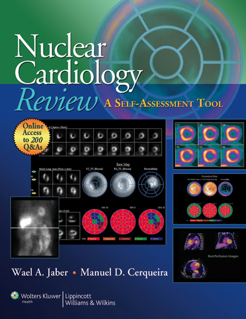 Nuclear Cardiology Review: A Self-Assessment Tool 1st Edition â€“ PDF/EPUB Version Downloadable