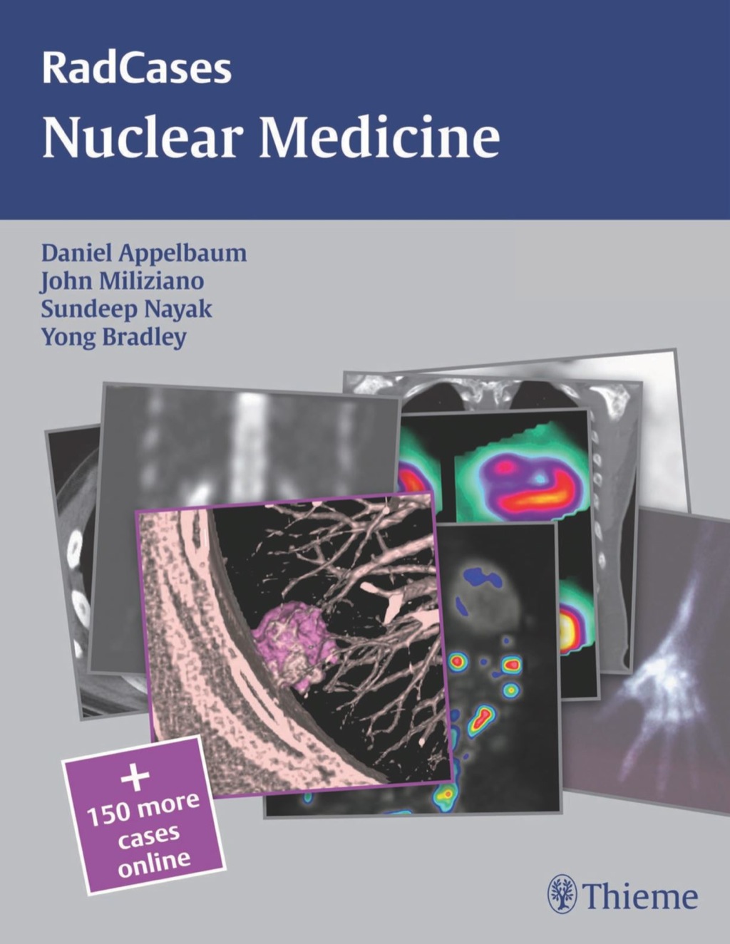 Nuclear Medicine 1st Edition – PDF/EPUB Version Downloadable Nuclear Medicine 1st Edition – PDF/EPUB Version Downloadable - Image 1