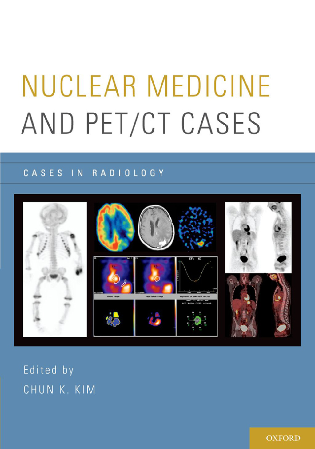 Nuclear Medicine and PET/CT Cases 1st Edition â€“ PDF/EPUB Version Downloadable