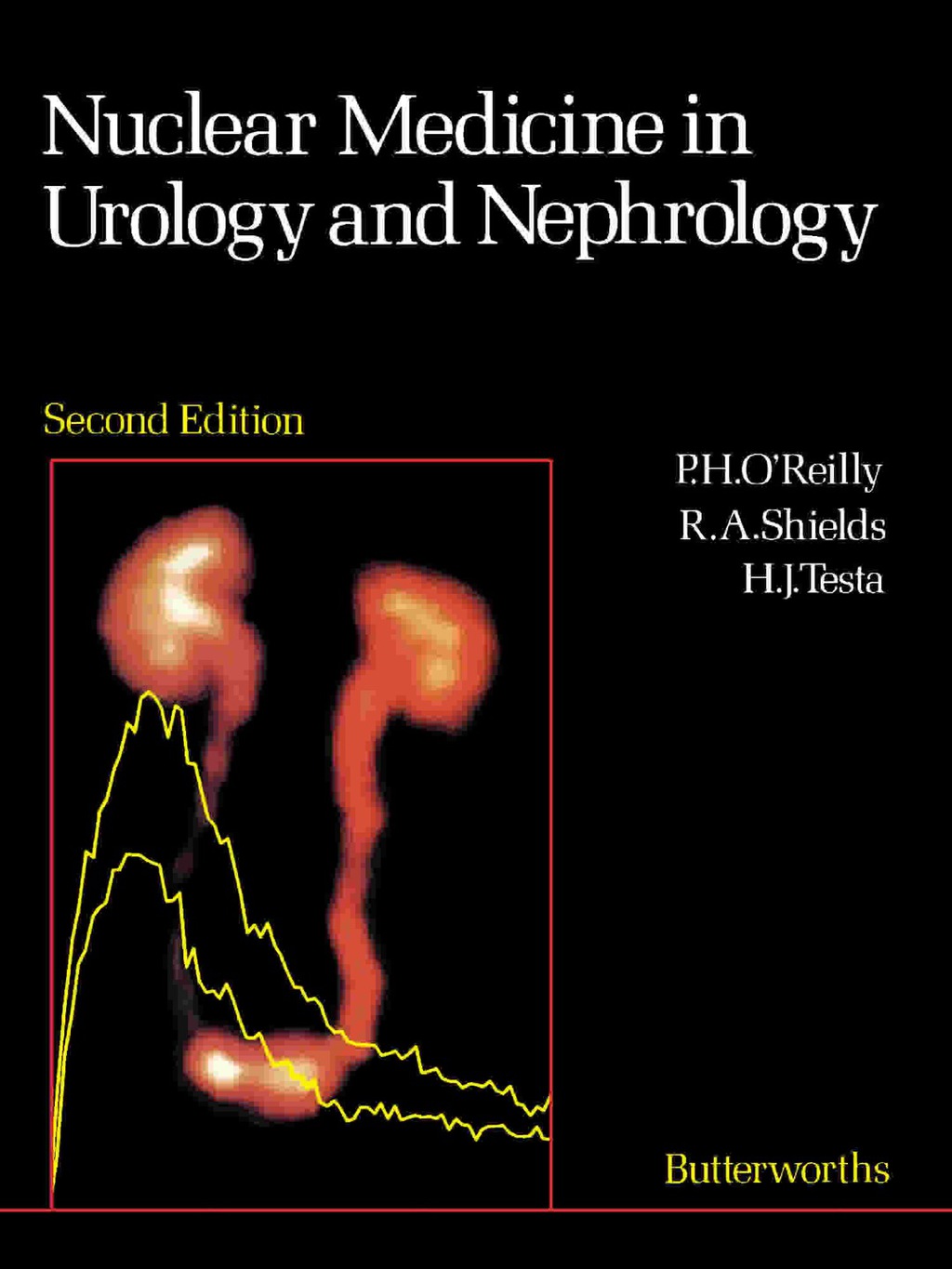 Nuclear Medicine in Urology and Nephrology 2nd Edition â€“ PDF/EPUB Version Downloadable