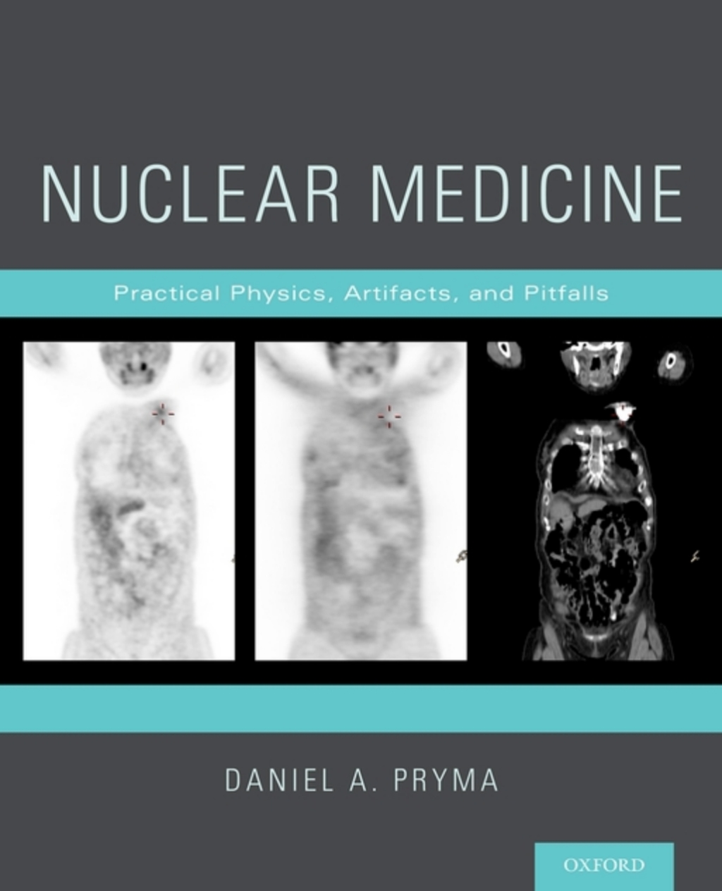 Nuclear Medicine Practical Physics, Artifacts, and Pitfalls  â€“ PDF/EPUB Version Downloadable