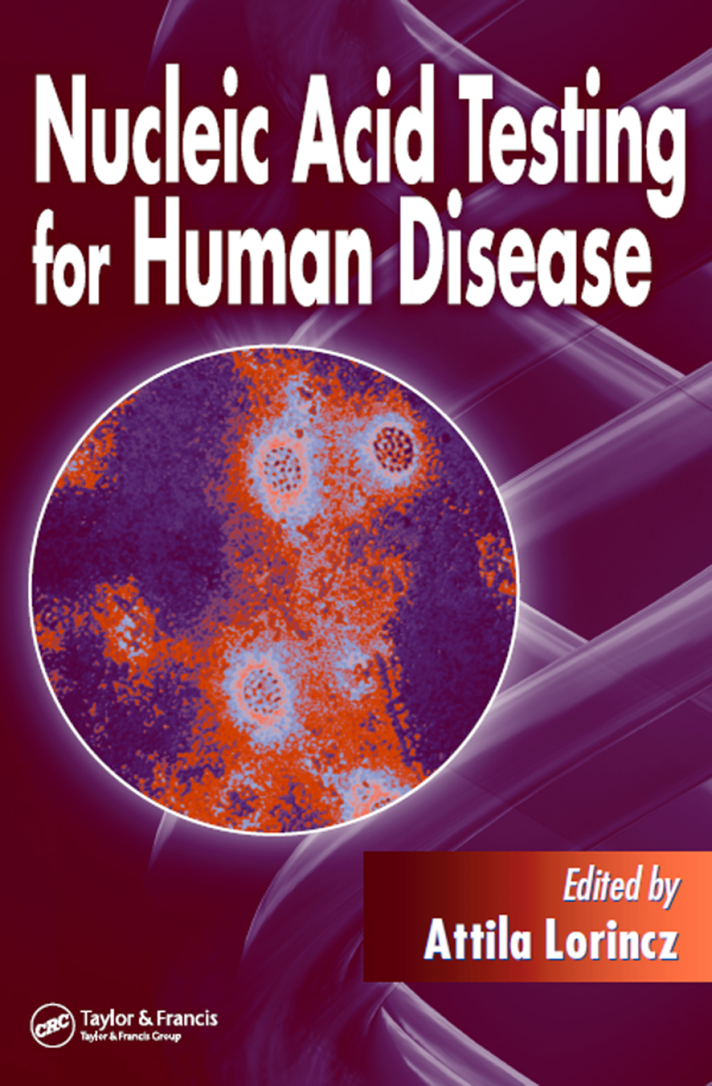 Nucleic Acid Testing for Human Disease 1st Edition â€“ PDF/EPUB Version Downloadable