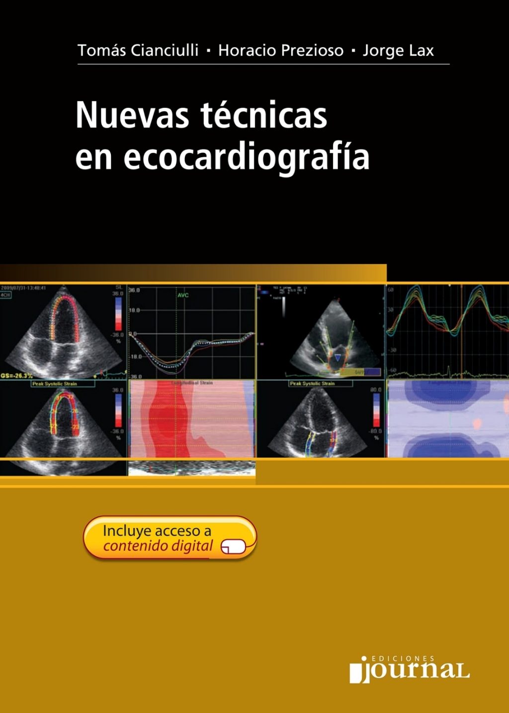Nuevas tÃ©cnicas en ecocardiografÃ­a 1st Edition â€“ PDF/EPUB Version Downloadable
