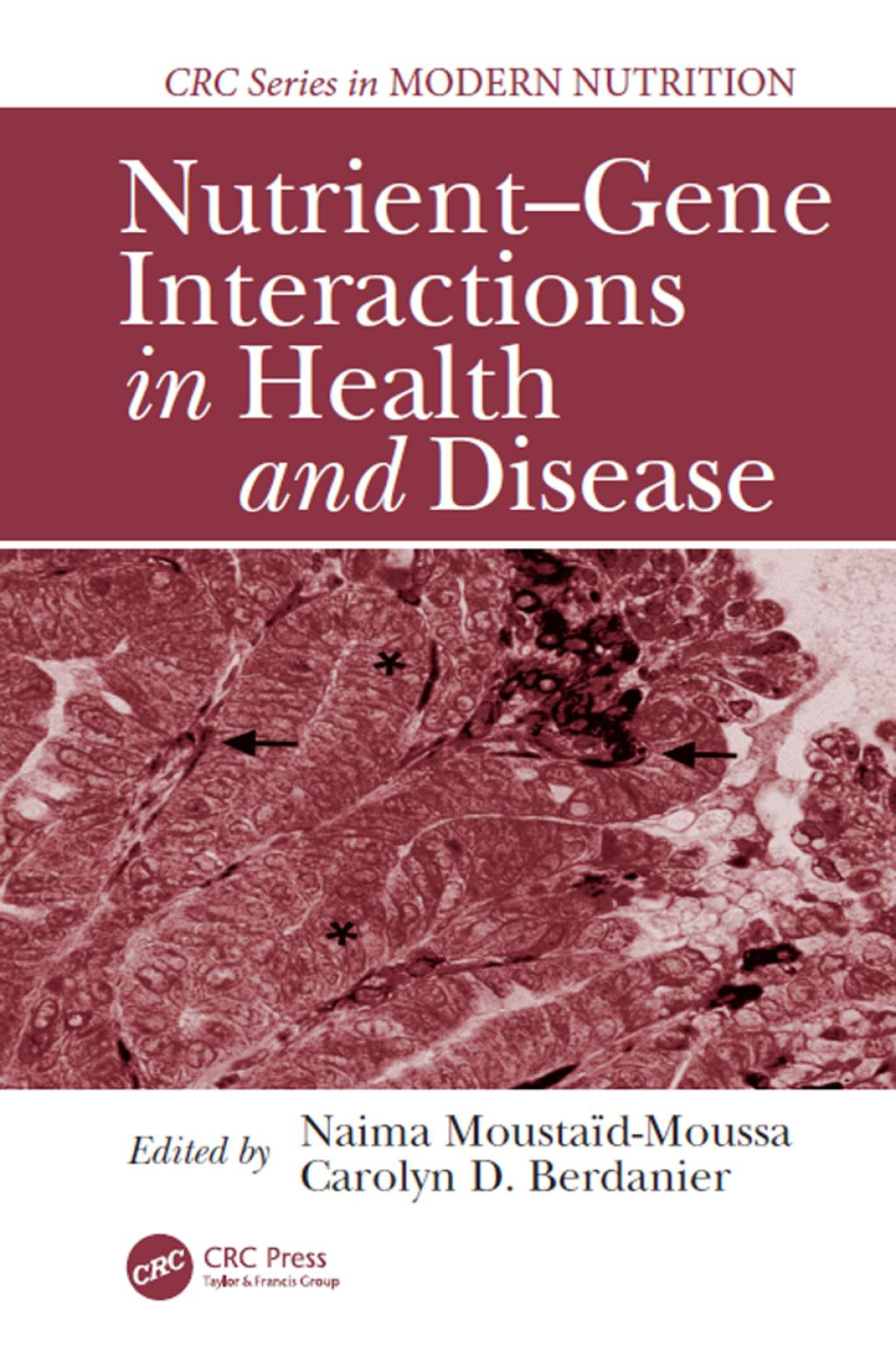 Nutrient-Gene Interactions in Health and Disease 2nd Edition â€“ PDF/EPUB Version Downloadable