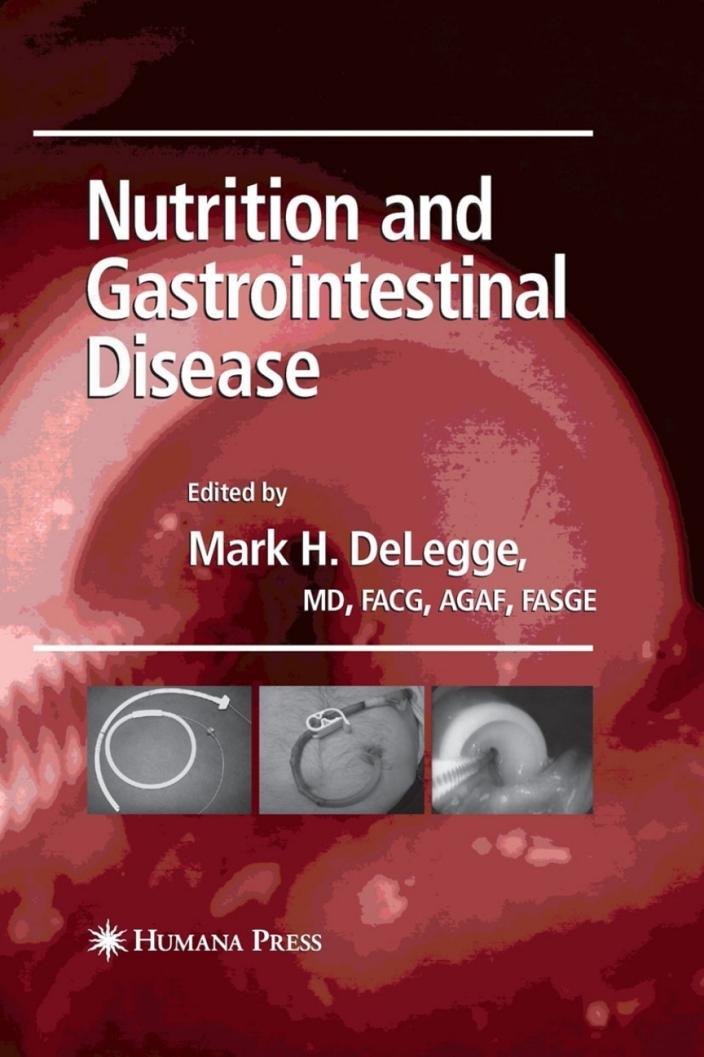 Nutrition and Gastrointestinal Disease 1st Edition â€“ PDF/EPUB Version Downloadable