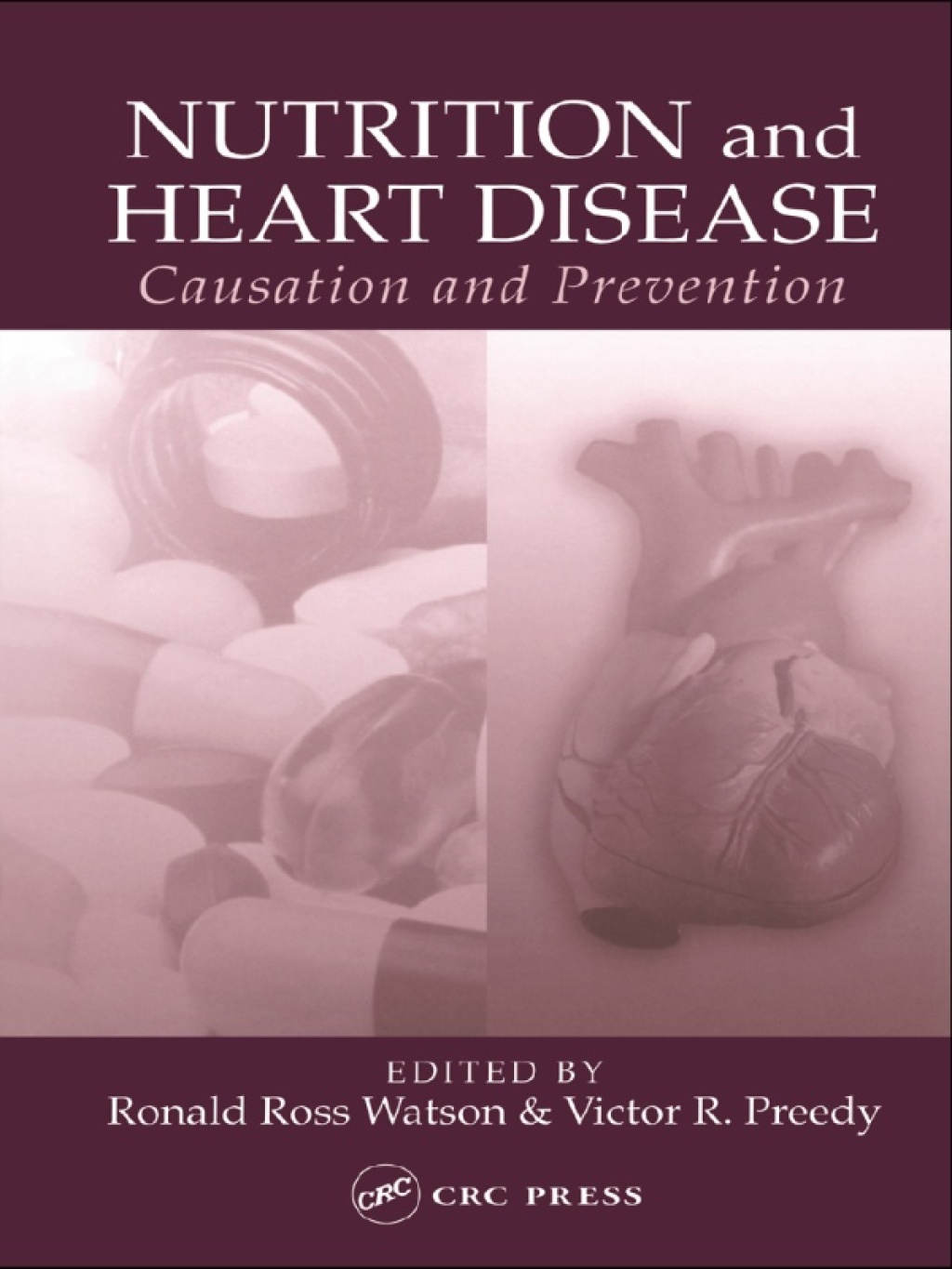 Nutrition and Heart Disease Causation and Prevention 1st Edition â€“ PDF/EPUB Version Downloadable