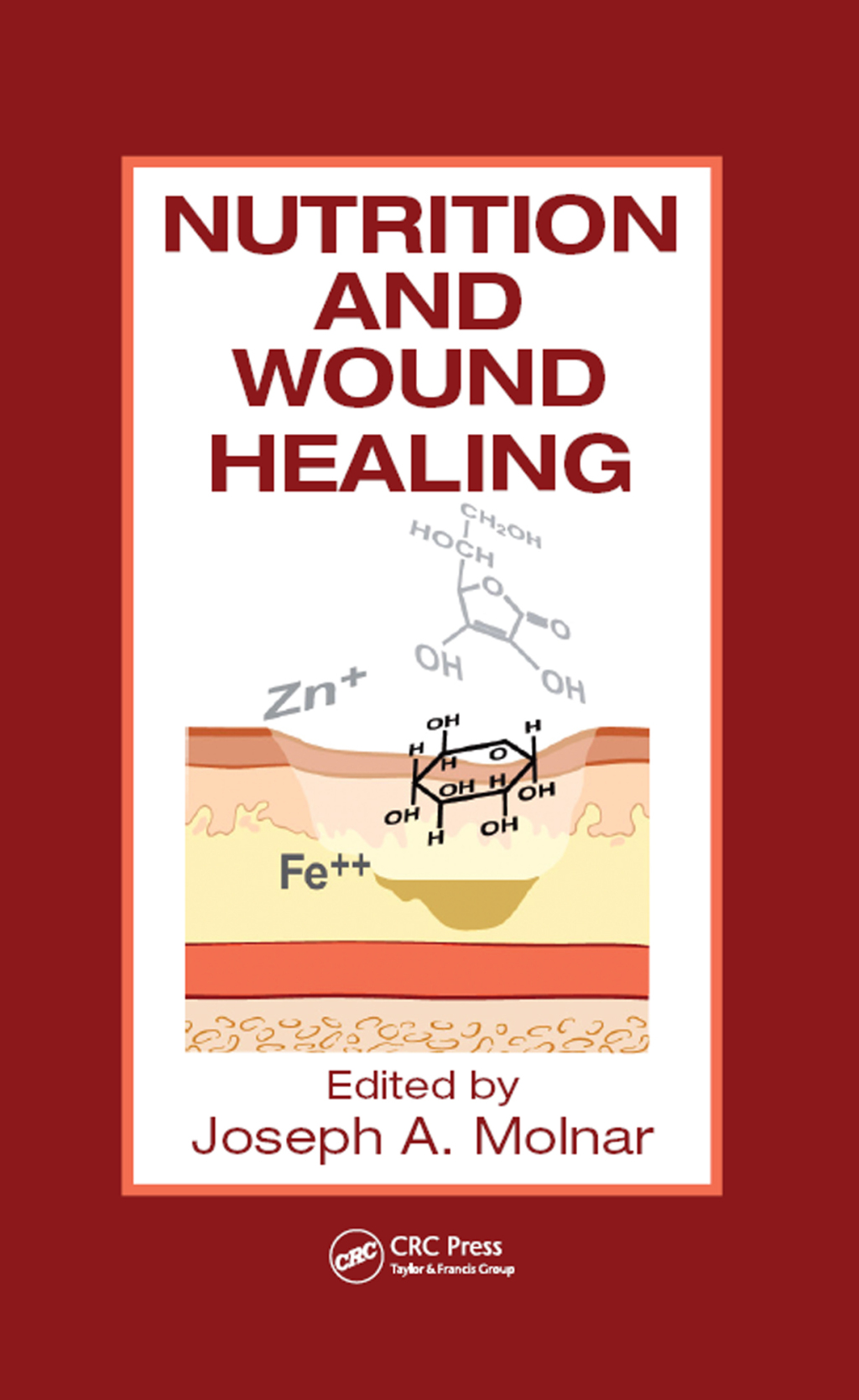 Nutrition and Wound Healing 1st Edition â€“ PDF/EPUB Version Downloadable