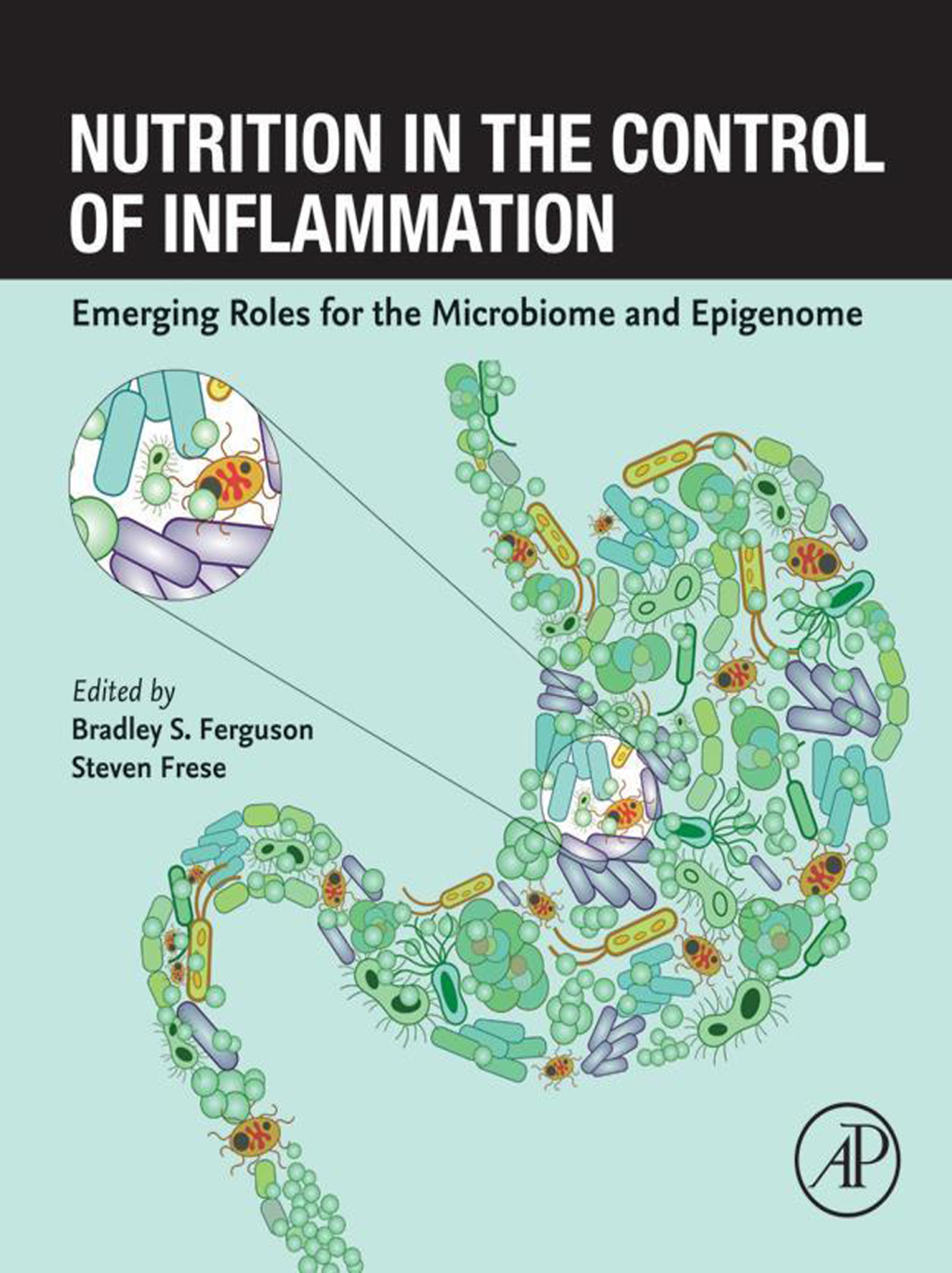 Nutrition in the Control of Inflammation Emerging Roles for the Microbiome and Epigenome  â€“ PDF/EPUB Version Downloadable
