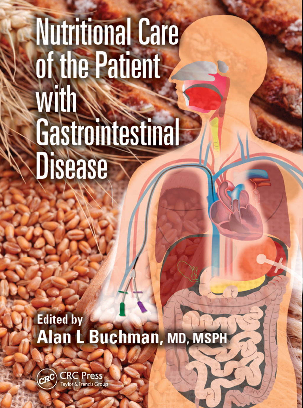 Nutritional Care of the Patient with Gastrointestinal Disease 1st Edition â€“ PDF/EPUB Version Downloadable