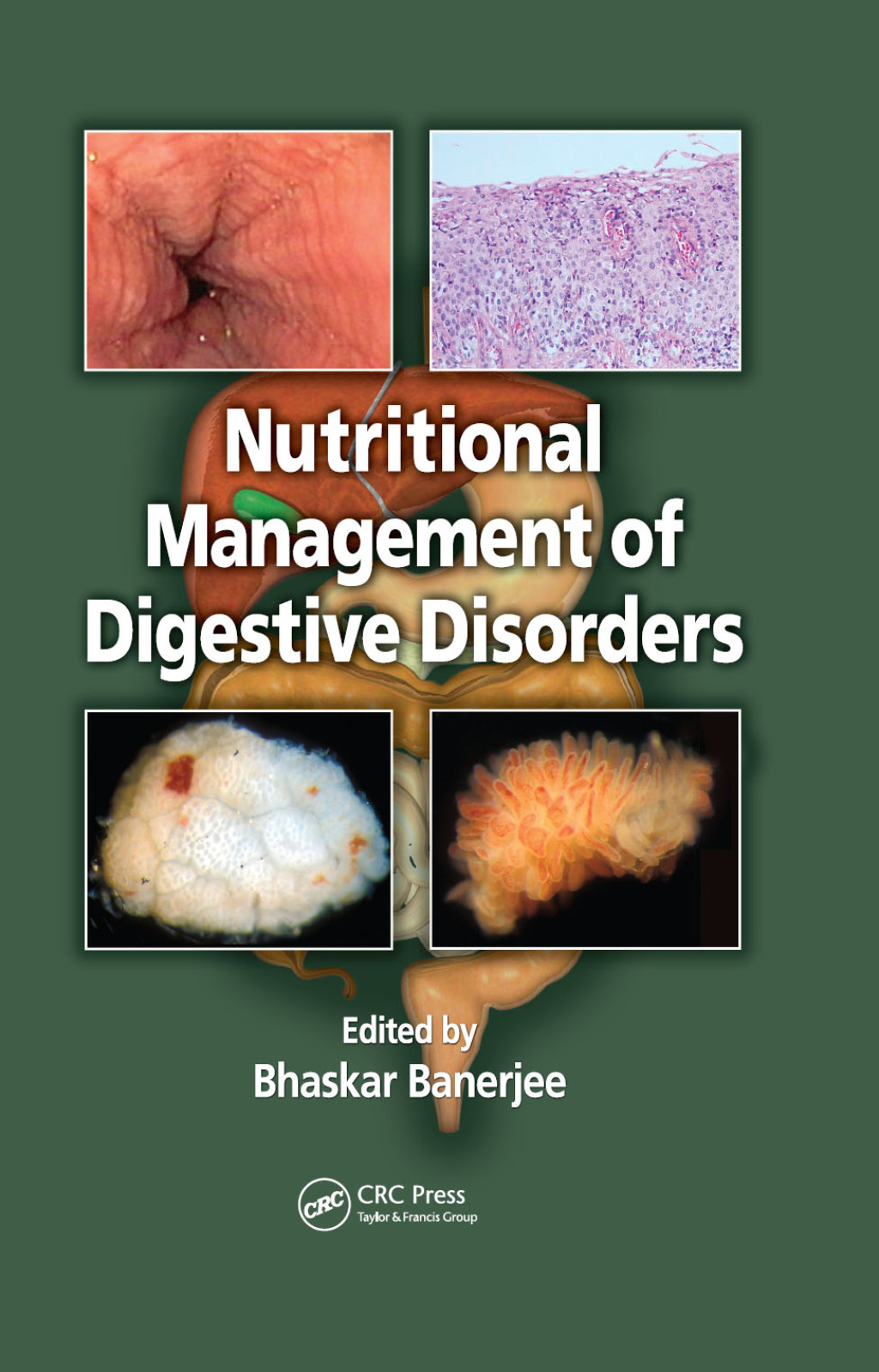 Nutritional Management of Digestive Disorders 1st Edition â€“ PDF/EPUB Version Downloadable