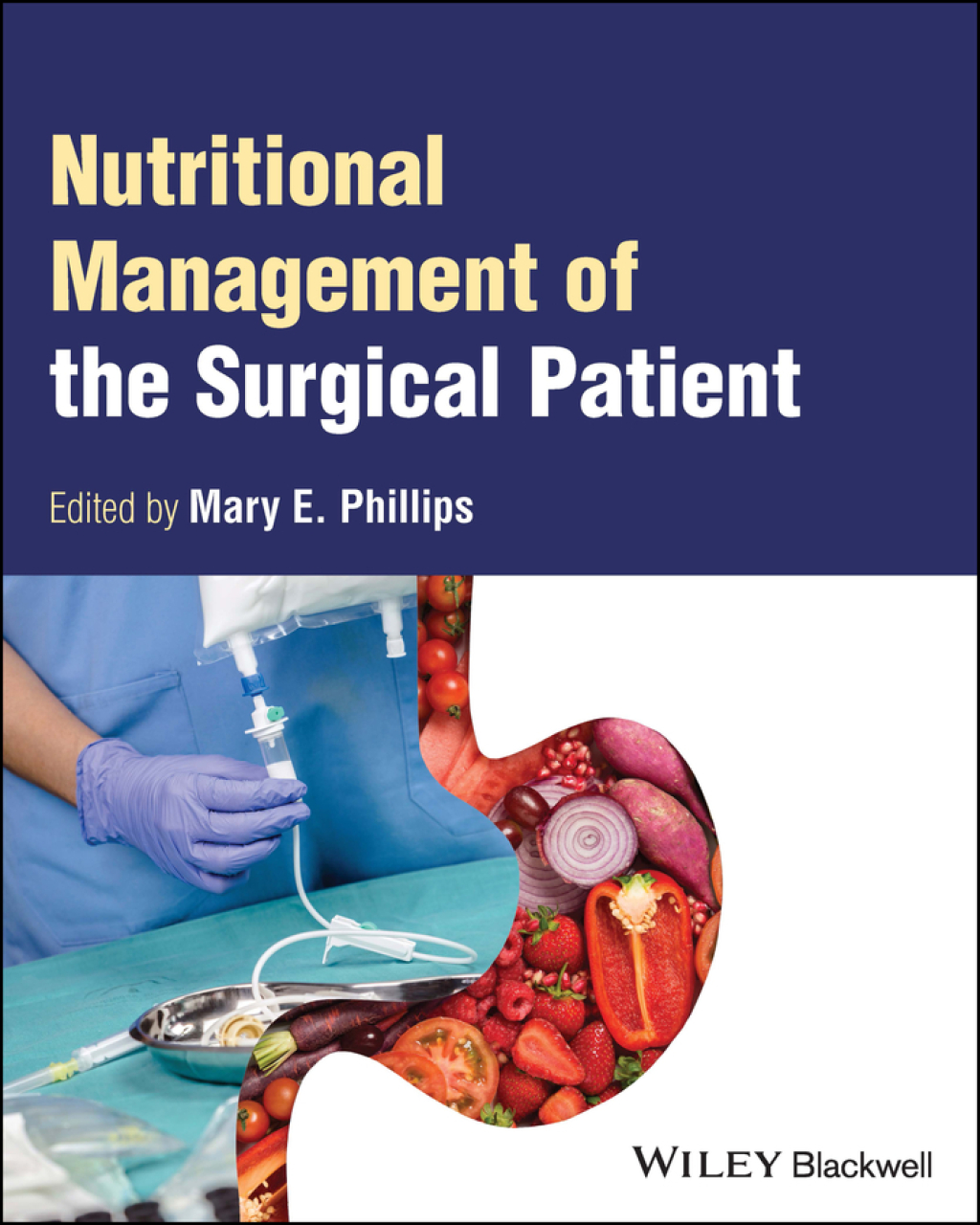 Nutritional Management of the Surgical Patient 1st Edition â€“ PDF/EPUB Version Downloadable