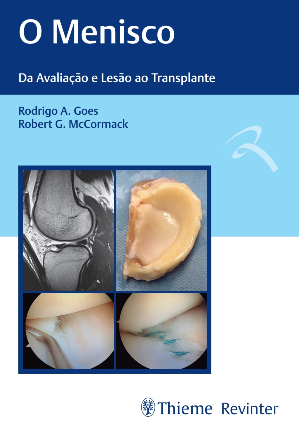 O Menisco: Da AvaliaÃ§Ã£o e LesÃ£o ao Transplante 1st Edition â€“ PDF/EPUB Version Downloadable