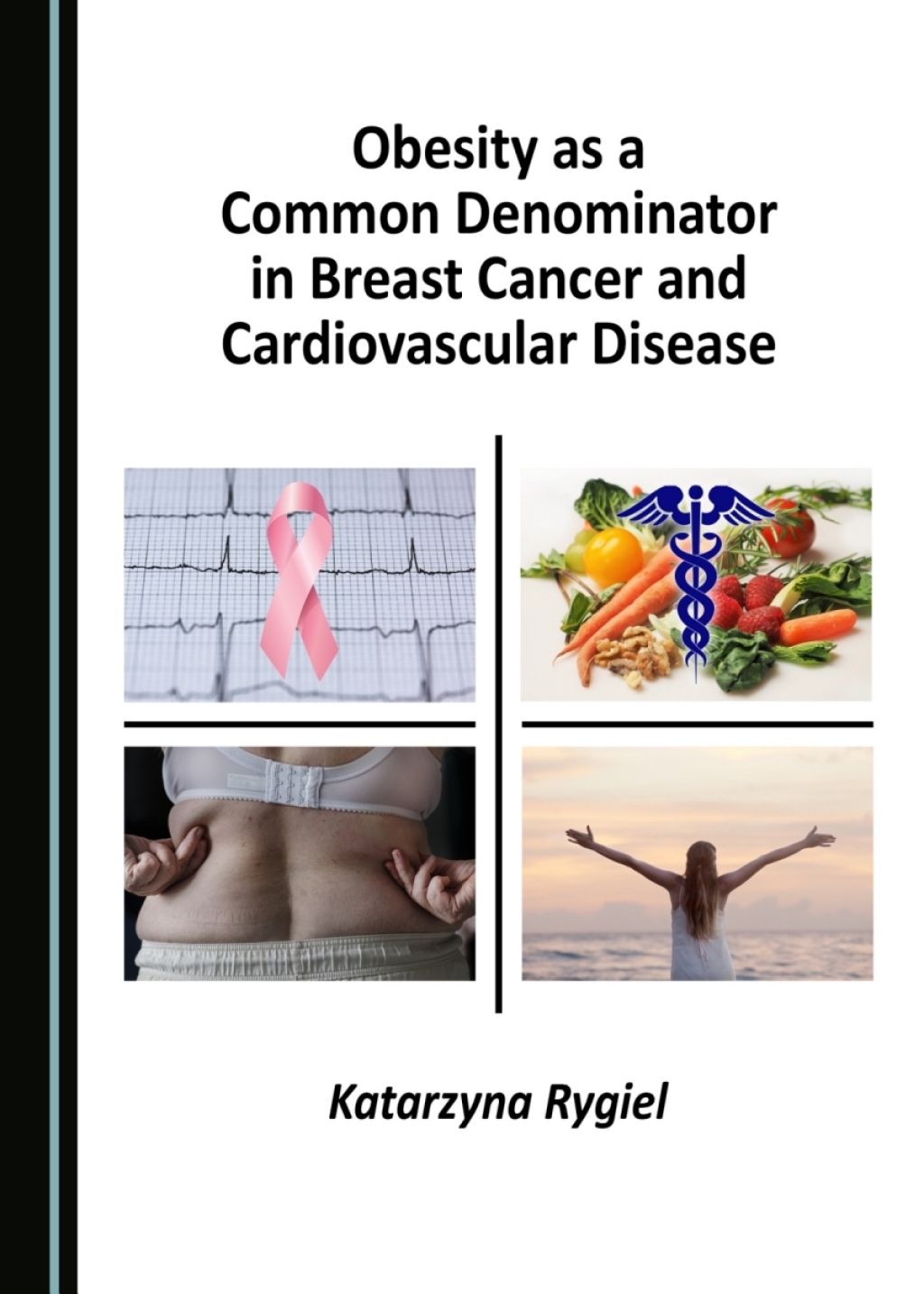 Obesity as a Common Denominator in Breast Cancer and Cardiovascular Disease 1st Edition â€“ PDF/EPUB Version Downloadable