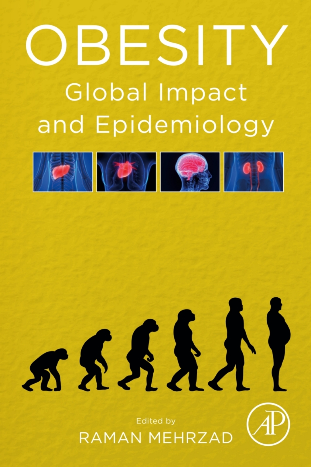 Obesity Global Impact and Epidemiology 1st Edition â€“ PDF/EPUB Version Downloadable