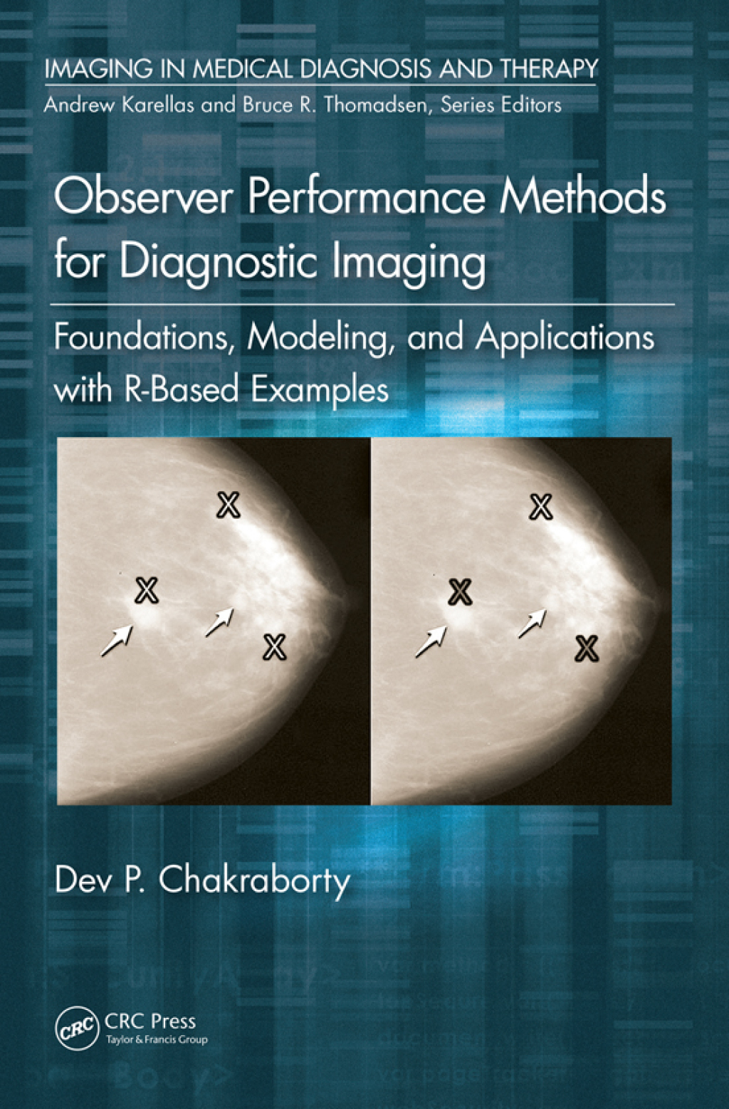 Observer Performance Methods for Diagnostic Imaging Foundations, Modeling, and Applications with R-Based Examples 1st Edition â€“ PDF/EPUB Version Downloadable