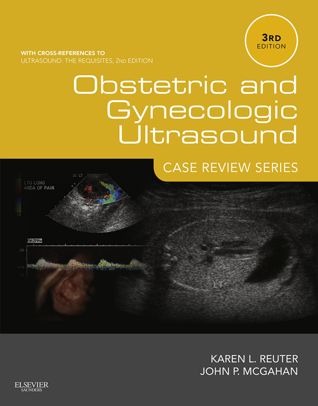 Obstetric and Gynecologic Ultrasound: Case Review Series 3rd Edition â€“ PDF/EPUB Version Downloadable