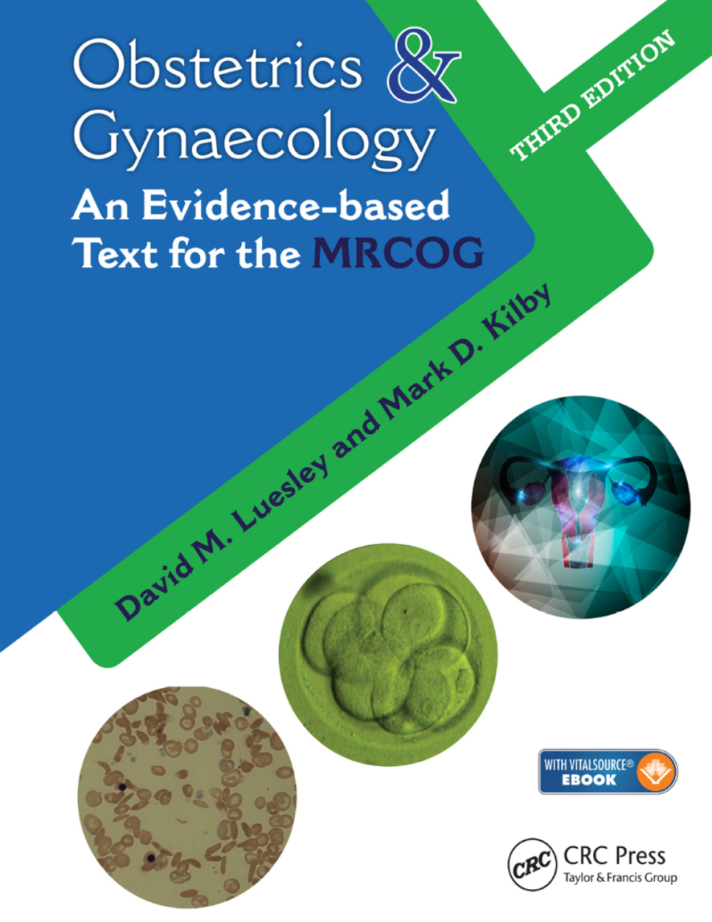 Obstetrics & Gynaecology An Evidence-based Text for MRCOG 3rd Edition â€“ PDF/EPUB Version Downloadable