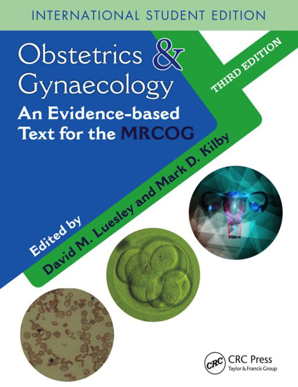 Obstetrics & Gynaecology An Evidence-based Text for MRCOG, Third Edition 3rd Edition â€“ PDF/EPUB Version Downloadable