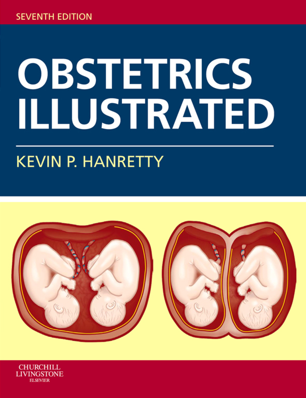 Obstetrics Illustrated 7th Edition â€“ PDF/EPUB Version Downloadable