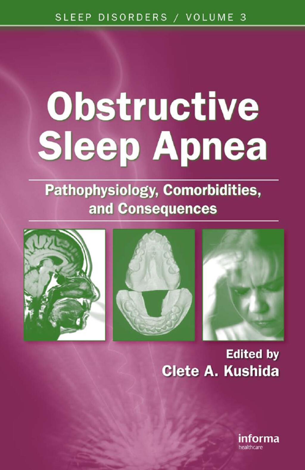 Obstructive Sleep Apnea: Pathophysiology, Comorbidities and Consequences Pathophysiology, Comorbidities, and Consequences 1st Edition â€“ PDF/EPUB Version Downloadable