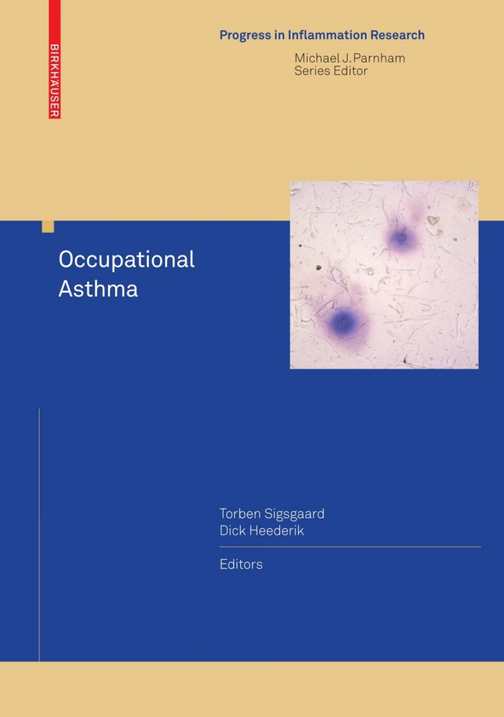 Occupational Asthma 1st Edition â€“ PDF/EPUB Version Downloadable