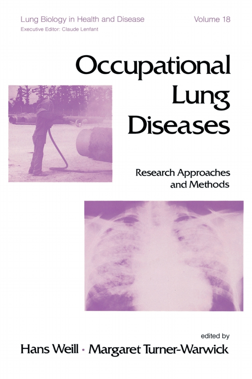 Occupational Lung Diseases Research Approaches and Methods 1st Edition â€“ PDF/EPUB Version Downloadable