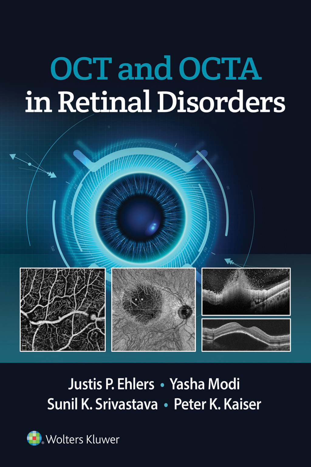 OCT and OCT Angiography in Retinal Disorders  â€“ PDF/EPUB Version Downloadable