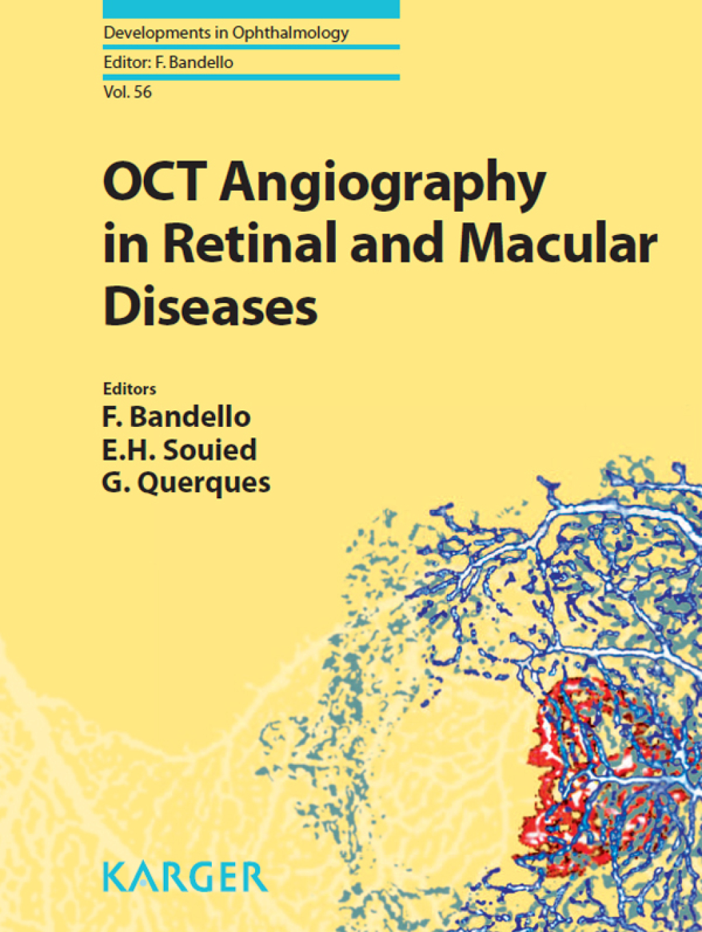 OCT Angiography in Retinal and Macular Diseases 1st Edition â€“ PDF/EPUB Version Downloadable