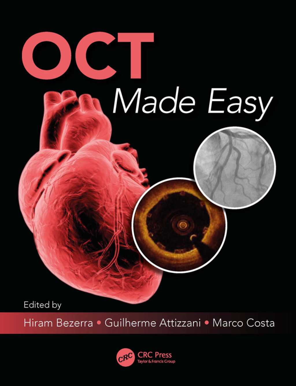 OCT Made Easy 1st Edition â€“ PDF/EPUB Version Downloadable
