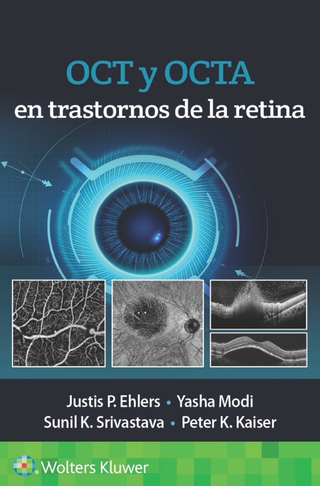 OCT y OCTA en trastornos de la retina  â€“ PDF/EPUB Version Downloadable