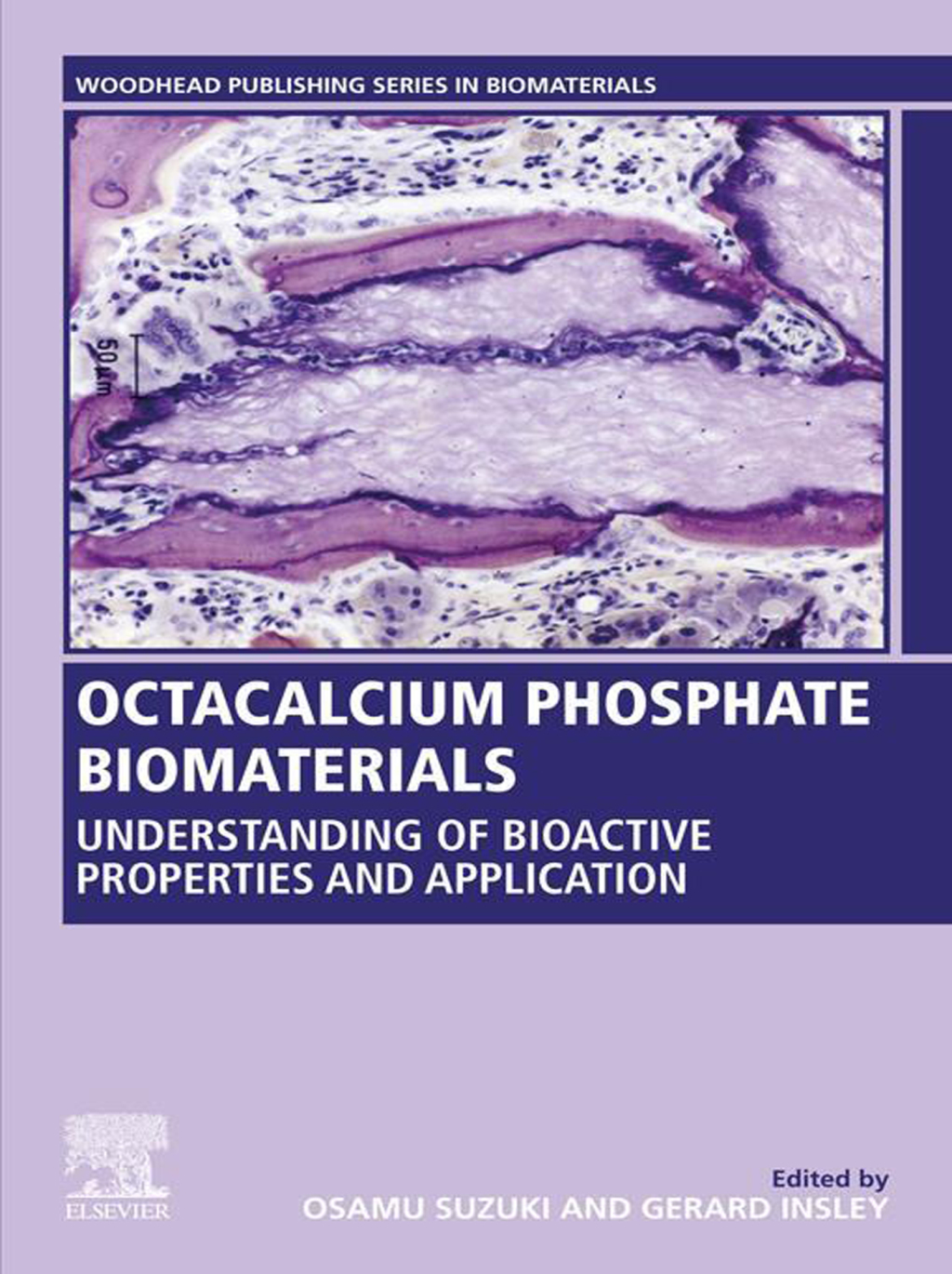 Octacalcium Phosphate Biomaterials Understanding of Bioactive Properties and Application  â€“ PDF/EPUB Version Downloadable