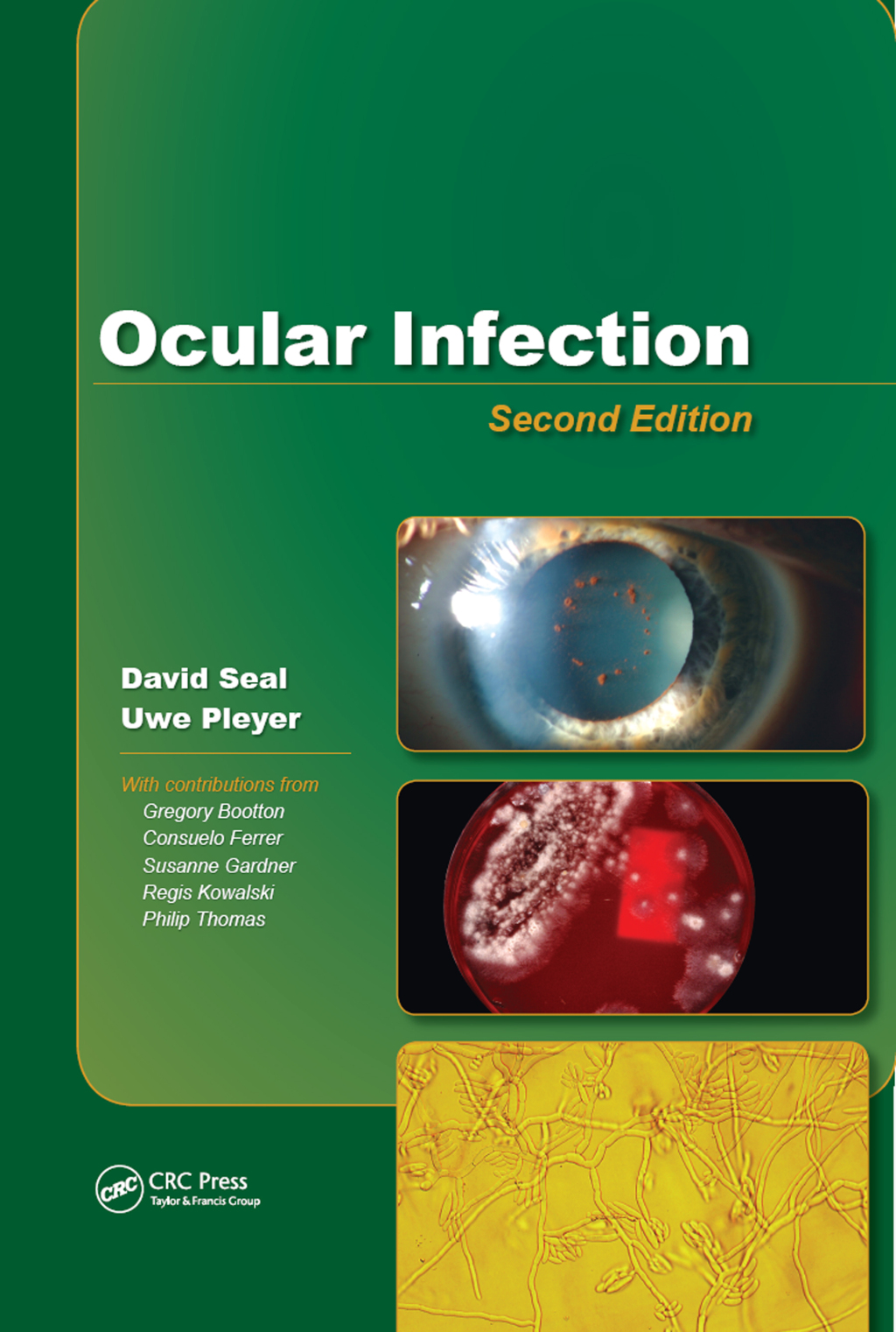 Ocular Infection Investigation and Treatment in Practice 2nd Edition â€“ PDF/EPUB Version Downloadable