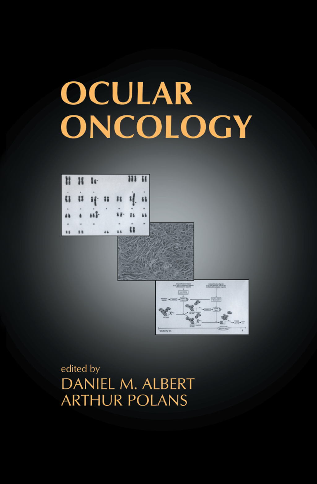 Ocular Oncology 1st Edition â€“ PDF/EPUB Version Downloadable