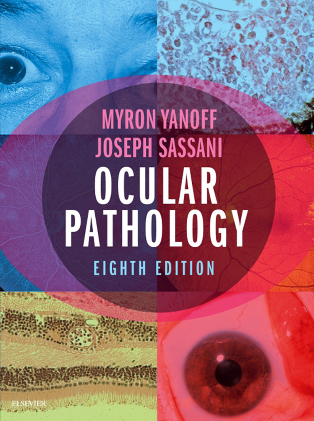Ocular Pathology 8th Edition â€“ PDF/EPUB Version Downloadable