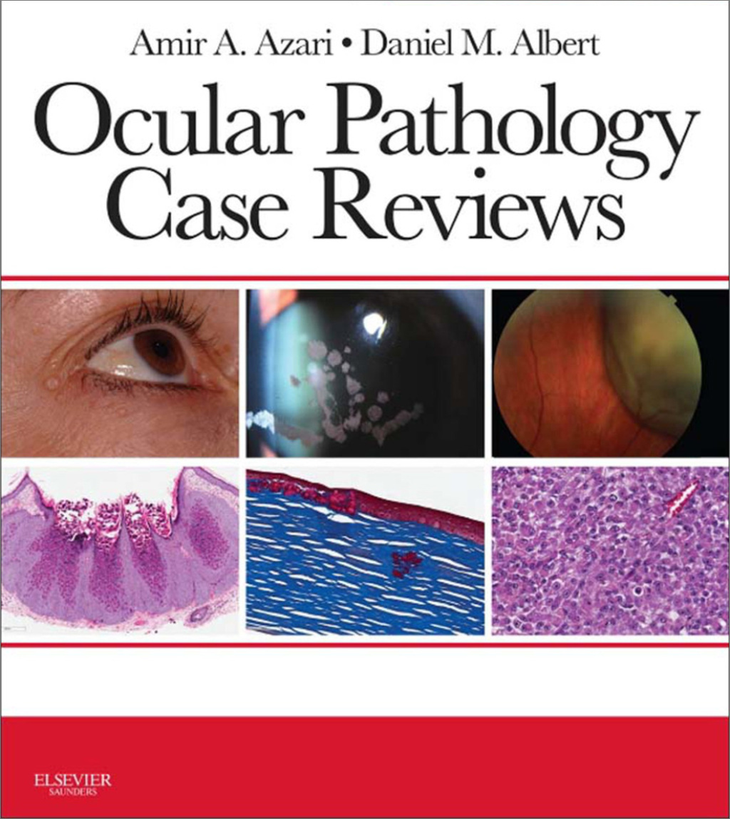 Ocular Pathology Case Reviews - Electronic 1st Edition â€“ PDF/EPUB Version Downloadable