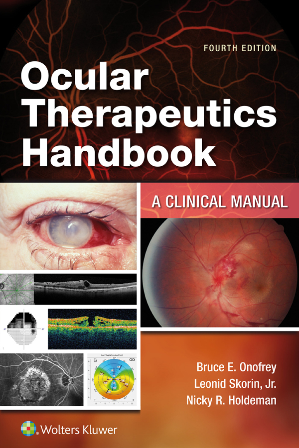 Ocular Therapeutics Handbook A Clinical Manual 4th Edition â€“ PDF/EPUB Version Downloadable