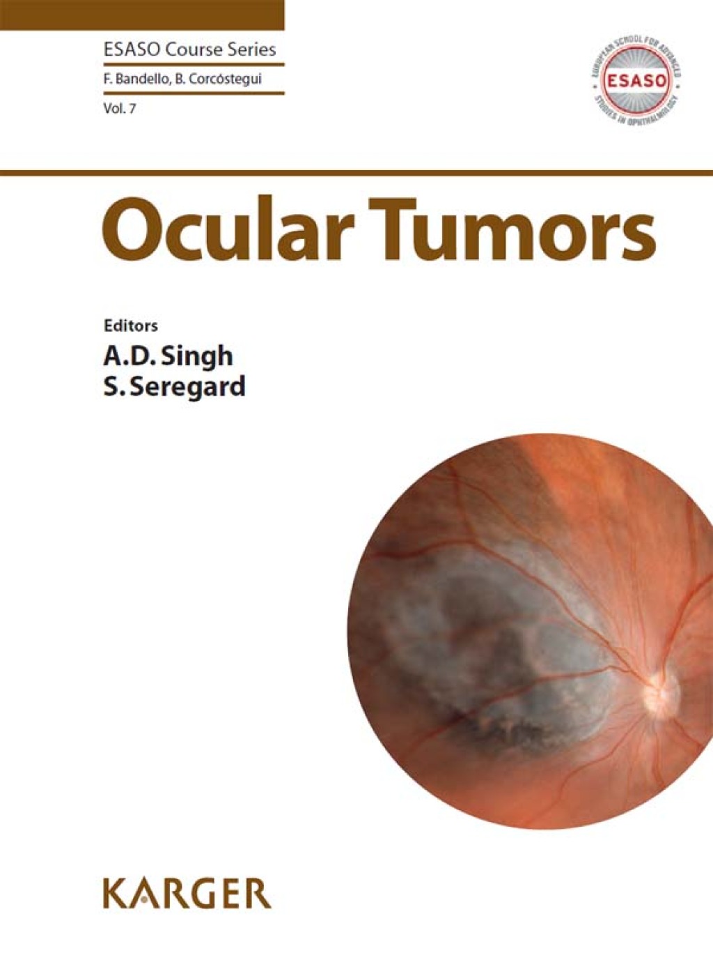 Ocular Tumors 1st Edition â€“ PDF/EPUB Version Downloadable