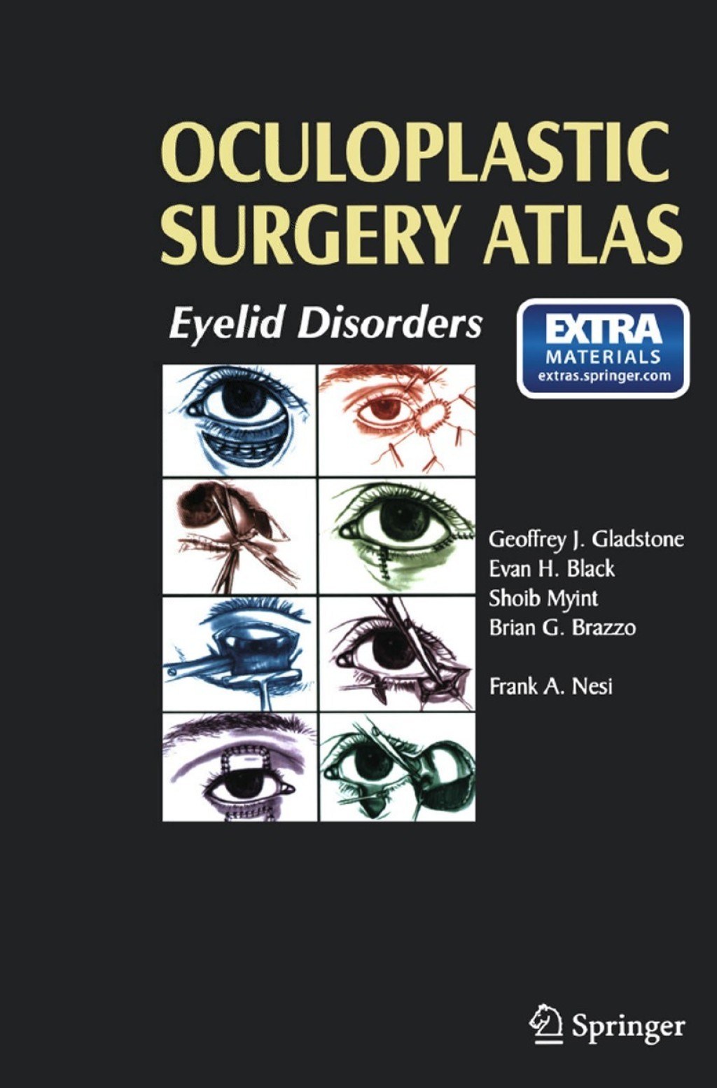 Oculoplastic Surgery Atlas Eyelid Disorders 1st Edition â€“ PDF/EPUB Version Downloadable