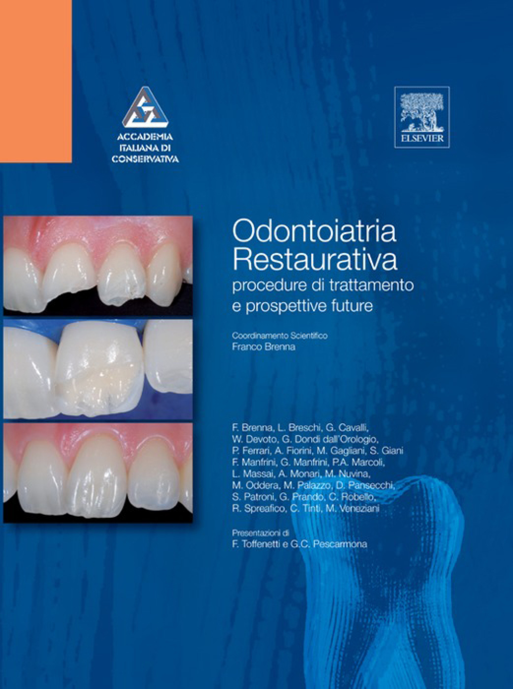 Odontoiatria restaurativa Procedure di trattamento e prospettive future 1st Edition â€“ PDF/EPUB Version Downloadable